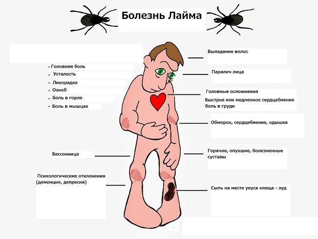 lyme-disease.jpg lyme-disease.jpg