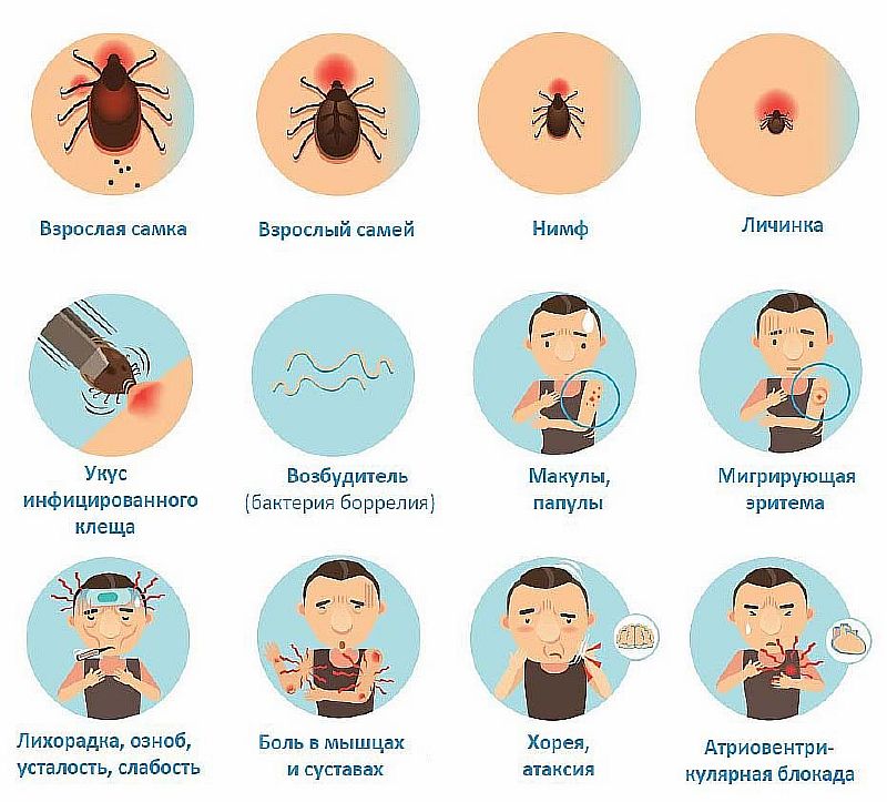 stadii-borrelioza-bolezni-lajma.jpg Диагностика боррелиоза
