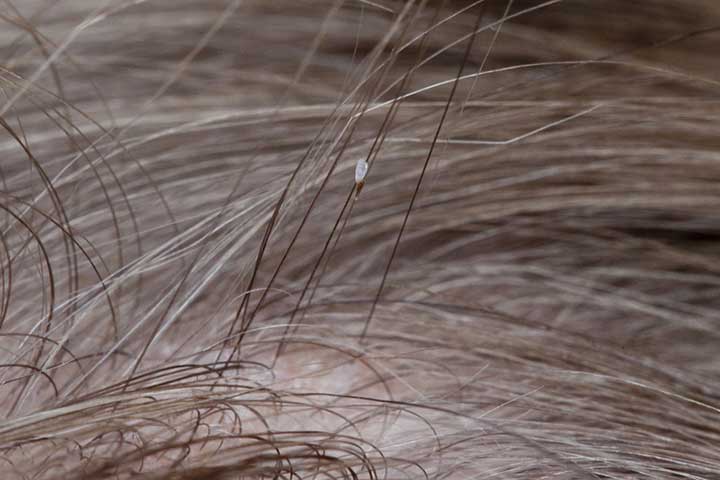 head-lice.jpg Фото гниды