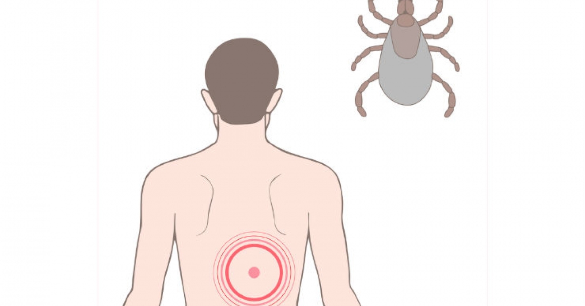 tick-season-means-lyme-disease.jpg Стадии боррелиоза