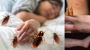 Кусаются ли тараканы? Укусы таракана: как определить, обработать, вылечить. Опасность.