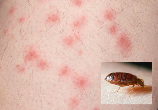 bed-bugs.jpg